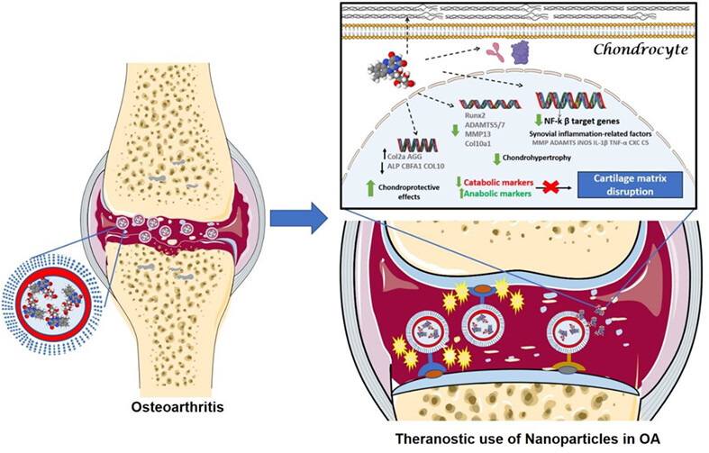 osteoartritis